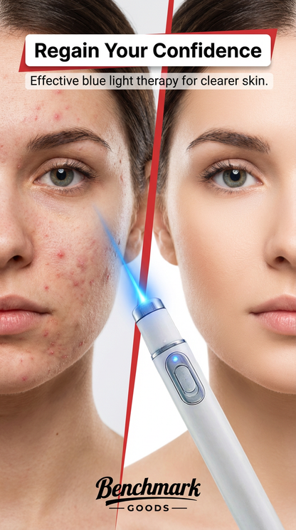 Blue light therapy pen for skincare