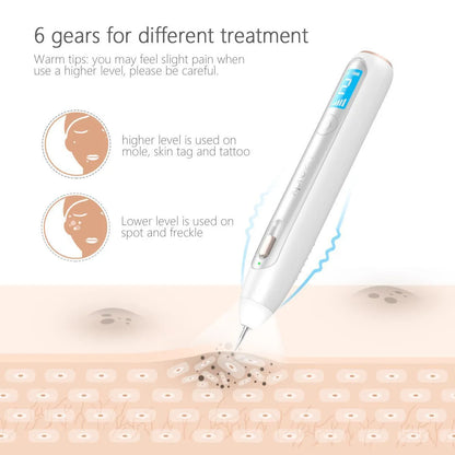 Advanced Plasma Pen Tattoo, Mole, Freckles and Skin Tag Eraser
